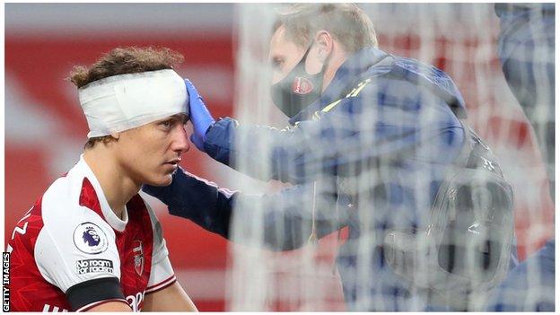 David Luiz treated for head injury