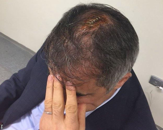 Besiktas head coach Senol Gunes receiving medical treatment at a hospital