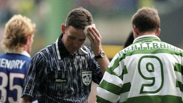 Referee Hugh Dallas mops up blood after being hit on the head by a coin in an Old Firm match in 1999