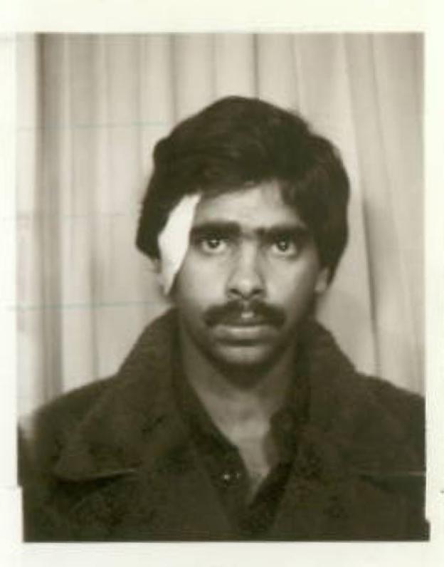 Suresh Grover passport photo, with bandaged wound