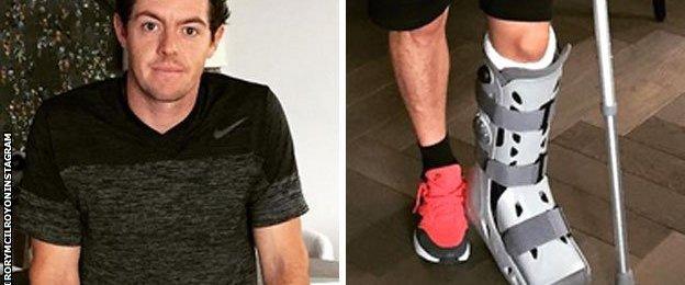 Rory McIlroy is in a protective boot after rupturing an ankle ligament