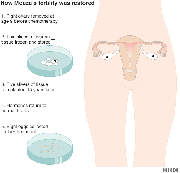 How Moaza's fertility was restored