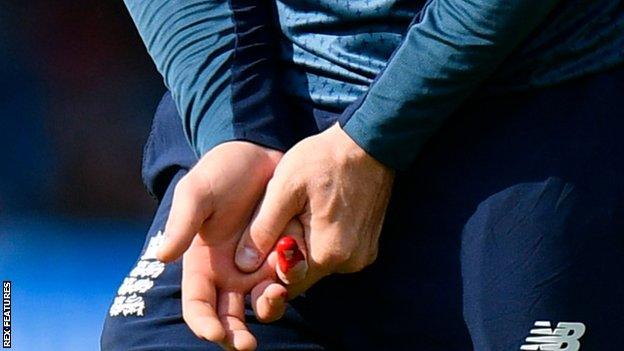 Jason Roy's injured finger