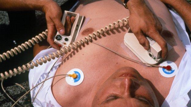 Man receiving defibrillator treatment