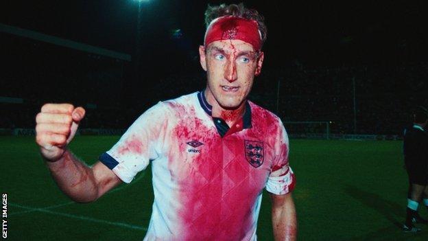 England's Terry Butcher, with blood covering his headband and shirt, celebrates after a goalless draw against Sweden in qualifying for the 1990 World Cup