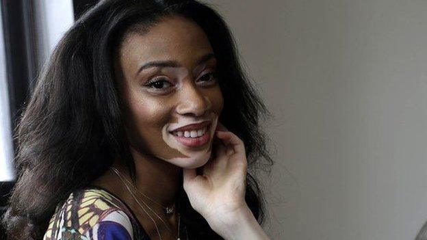 Winnie Harlow