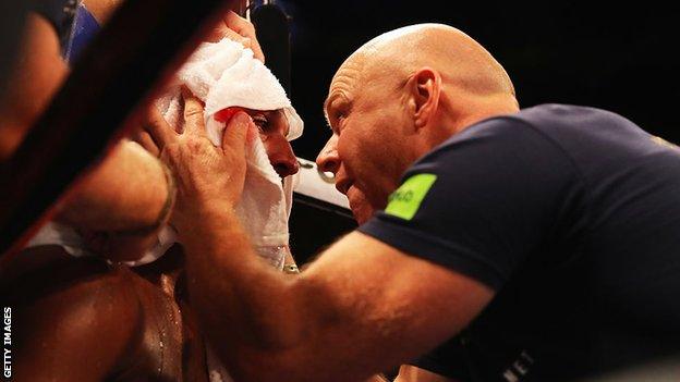 Under proposed rules, trainers and those in the corner will need to wear a protective mask at fight nights