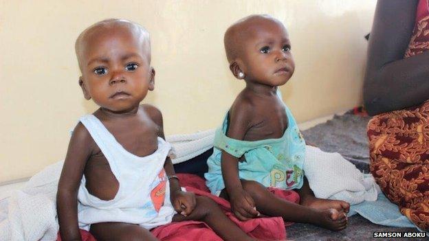 Malnourished children being treated at Yola's main hospital