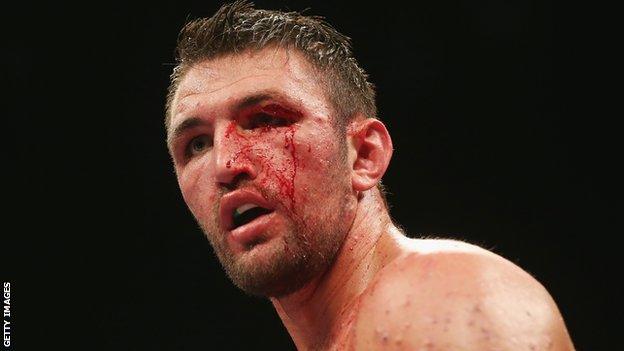 Hughie Fury