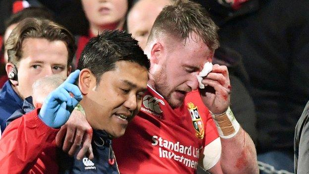 Stuart Hogg is led off the pitch in Christchurch