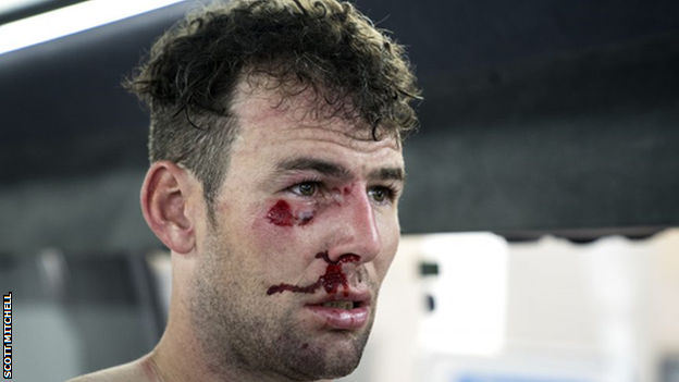 Mark Cavendish was injured twice in March