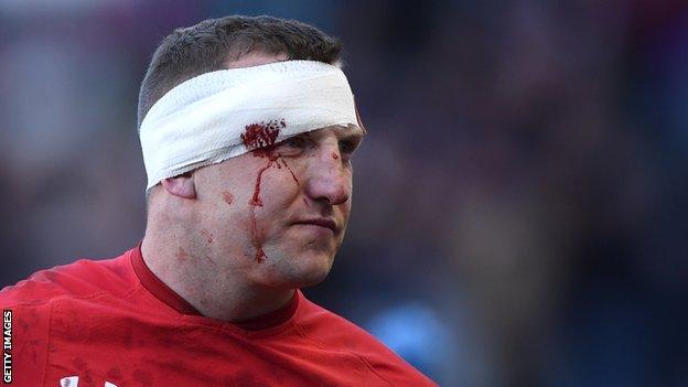 Wales centre Hadleigh Parkes