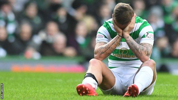 Celtic striker Leigh Griffiths appeared to suffer a recurrence of a calf problem in the first half