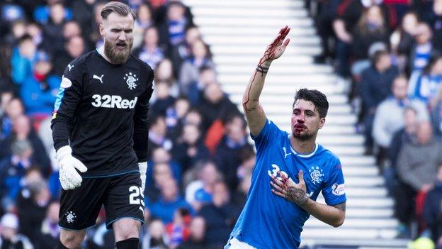 Rangers defender Fabio Cardoso