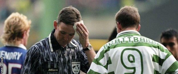 Hugh Dallas cleans blood from his head after being struck by a coin during a derby game at Celtic Park