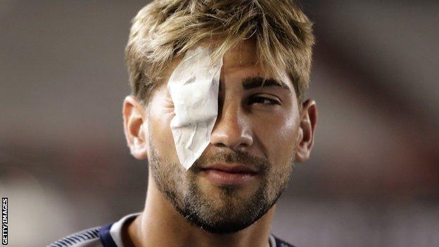 Gonzalo Lamard wears a patch covering his right eye following the attack on the Boca Juniors team bus