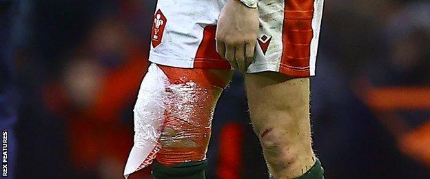 Dan Biggar's knee had an ice strapping after Wales' win against Scotland