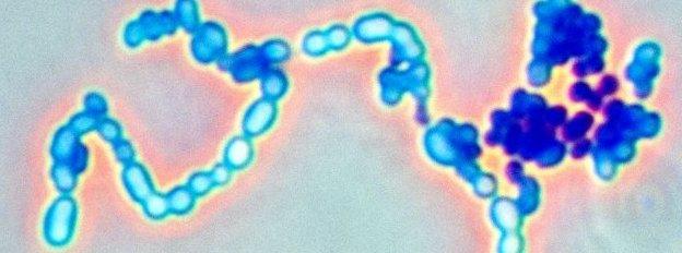 Streptococcus bacteria