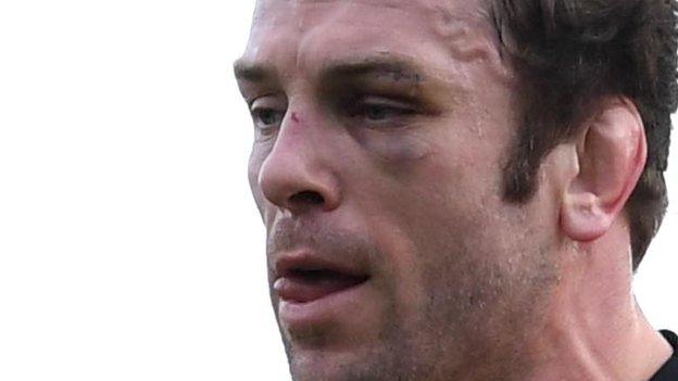 Alun Wyn Jones sported damage around his left eye following the training incident