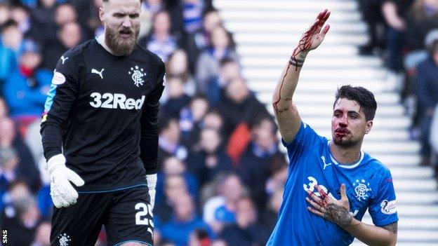 Rangers defender Fabio Cardoso calls for assistance after having his nose broken