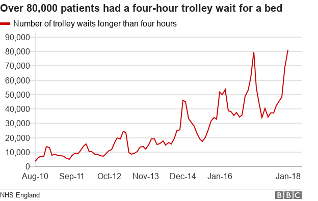 Trolley wait chart