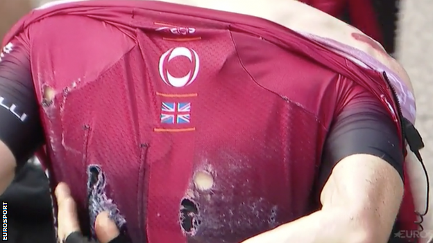 Geraint Thomas' torn shirt after his crash at the Tour of Switzerland