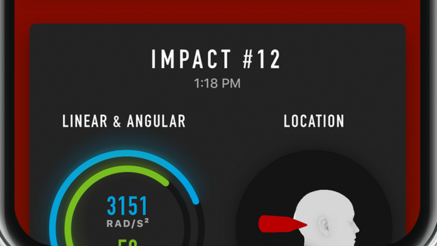 Smart Mouthguards: What are they, and how can they help rugby players ...
