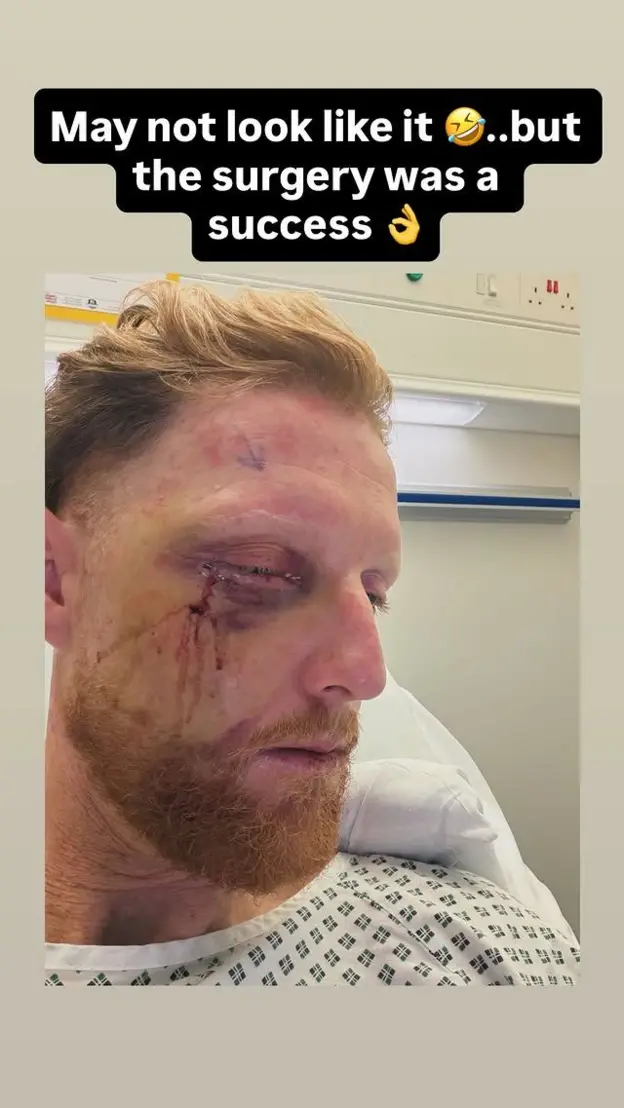 A photo of England Test captain Ben Stokes following surgery 