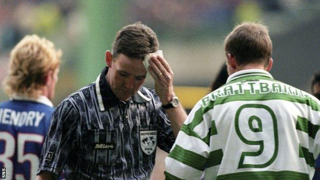 Referee Hugh Dallas mops a head wound during the 1999 title decider between Celtic and Rangers