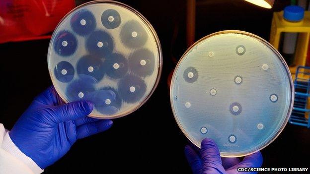 lab tests for antibiotic resistance