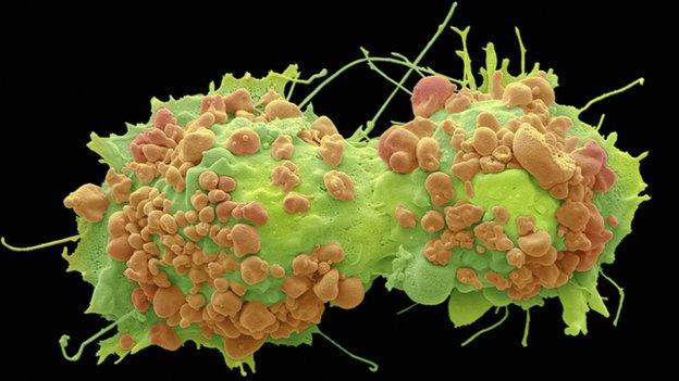 cancer cells