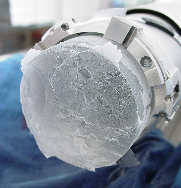 EPICA ice core