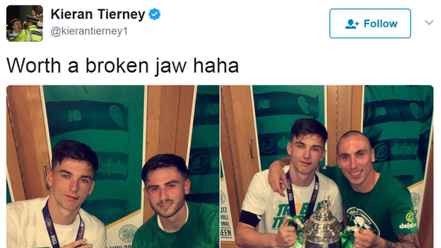 Kieran Tierney tweet