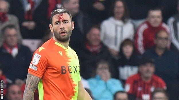 Nottingham Forest's Steve Cook with a bloodied head against Bournemouth