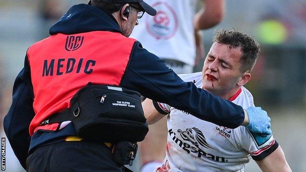 Michael Lowry receives treatment after sustaining a facial injury against the Sharks in the game on 20 Mayo