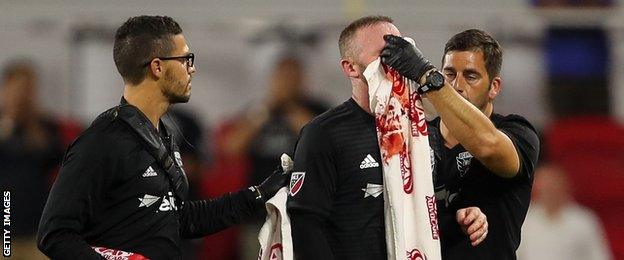 A towel is used to staunch the flow of blood from Wayne Rooney's nose