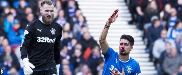 Jak Alnwick and Fabio Cardoso