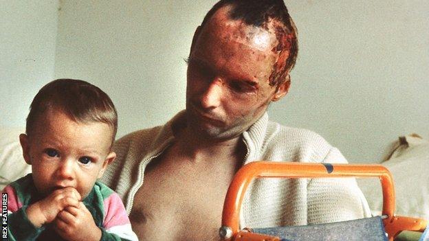 Niki Lauda with his son after the fire at the Nurburgring