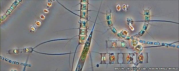 Microscope picture of plankton