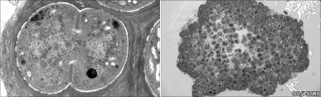 OU-20 - single (left) and colony (right) (OU PSSRI)