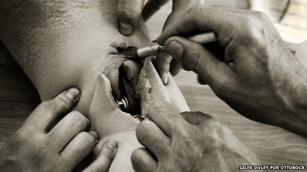 Technician cutting open the foam covering of an above-knee prosthetic leg with a scalpel to expose the mechanical knee joint