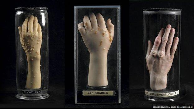 Wax hands made by Joseph Towne on display at the Museum of London