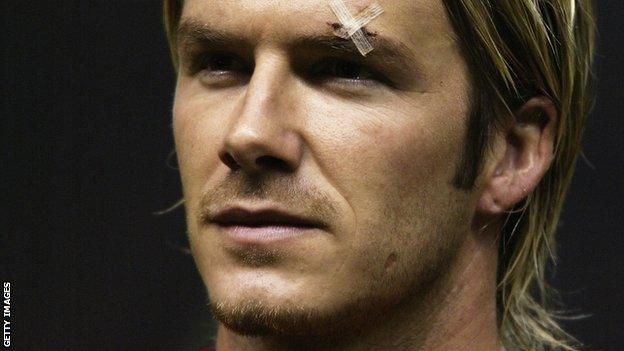 David Beckham cut eye