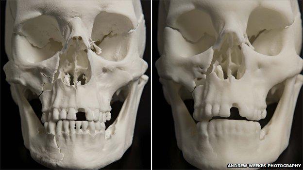 The new reconstruction of the skull and the old one