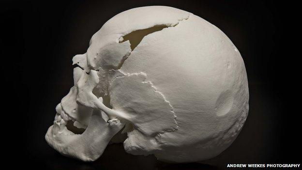 The new reconstruction of the skull from the side