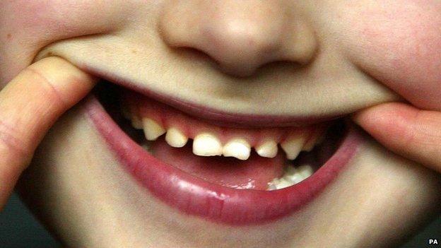 Boy's teeth