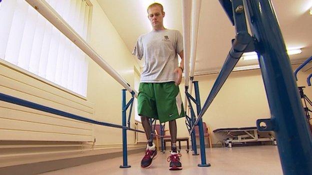 Mark Ormrod with his new bionic prosthetics