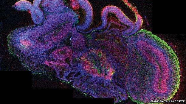 Image of the cells in the mini lab-grown brain