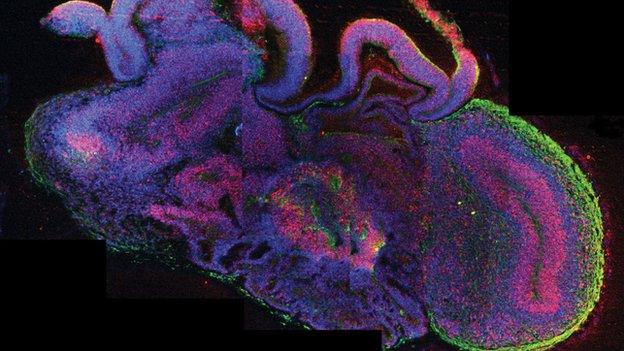 Image of the cells in the mini lab-grown brain