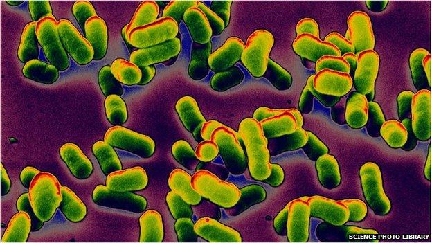 Clusters of the bacteria that cause bubonic plague